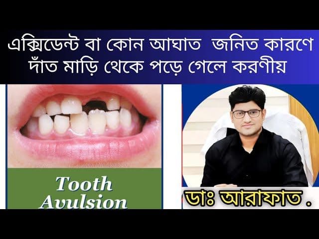 avulsed tooth