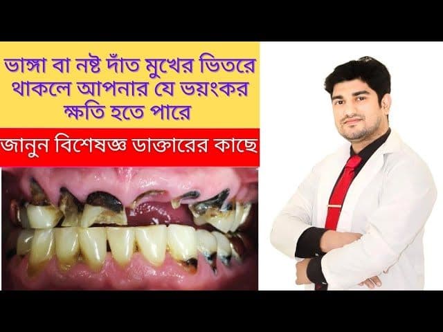 tooth extraction causes