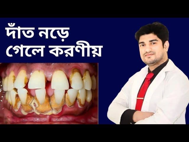 mobile teeth treatment